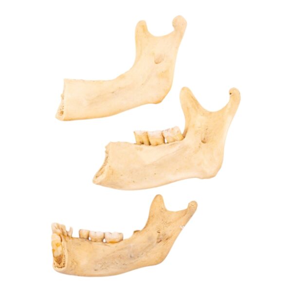 Real Human Partial Mandible – Set of 3 – 100 g
