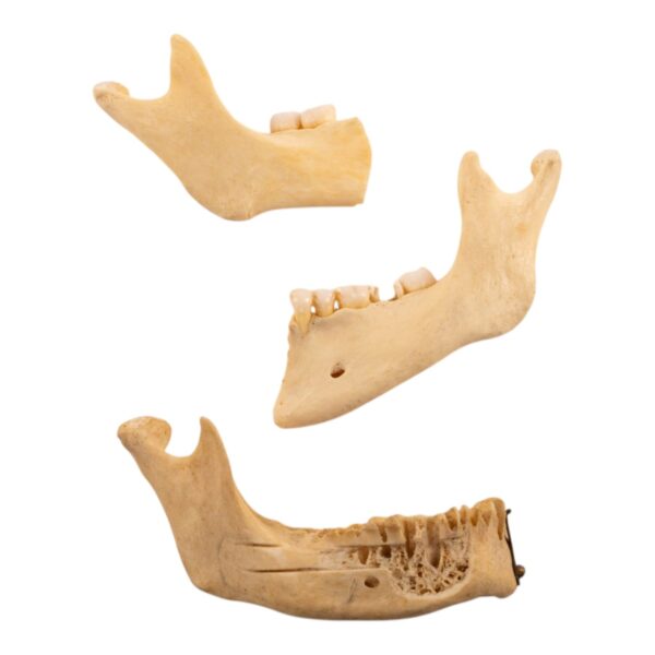 Real Human Partial Mandible – Set of 3 – 74 g