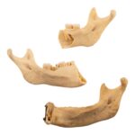Real Human Partial Mandible – Set of 3 – 74 g