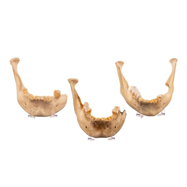 Real Human Mandible – Set of 3