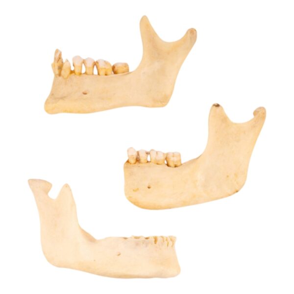 Real Human Partial Mandible – Set of 3 – 88 g