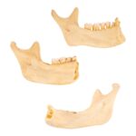 Real Human Partial Mandible – Set of 3 – 88 g