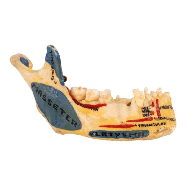 Real Human Partial Mandible – Painted