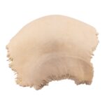Real Human Fused Parietal Halves