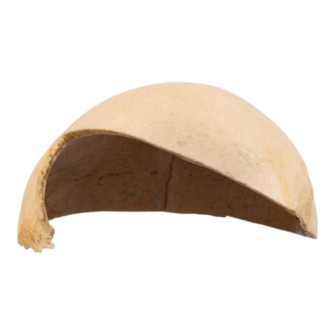Real Human Partial Calvaria