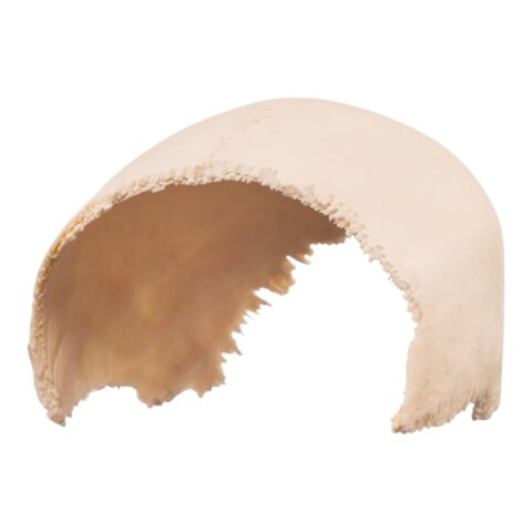 Real Human Skull Cap – Parietal Bones