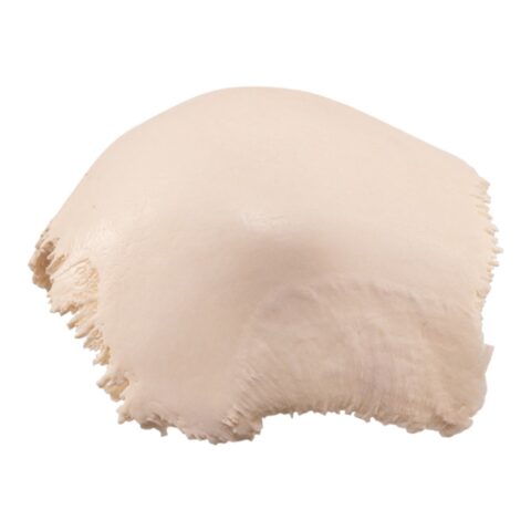 Real Human Skull Cap – Parietal Bones