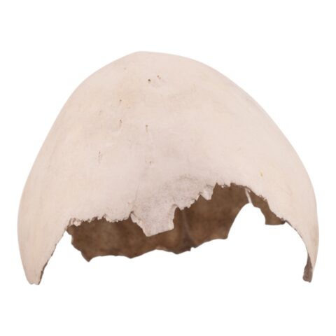 Real Human Child Partial Skull