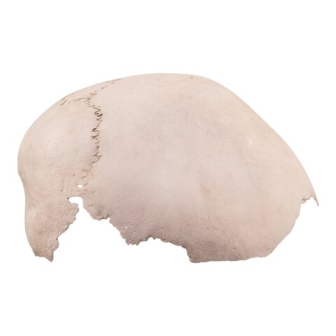 Real Human Child Partial Skull