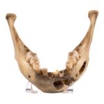 Real Human Mandible – Young