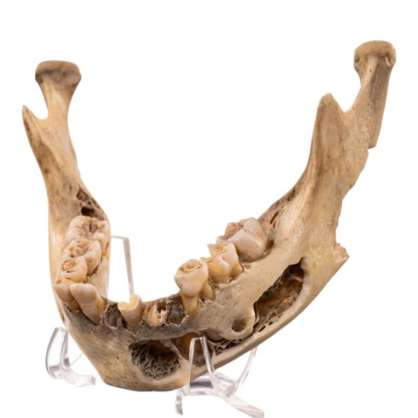 Real Human Mandible – Young