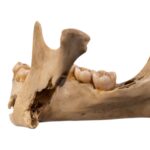 Real Human Mandible – Young