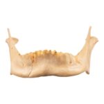 Real Human Mandible – Repaired