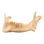 Real Human Mandible – Repaired