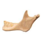 Real Human Mandible – Repaired