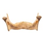 Real Human Mandible – Repaired