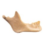 Real Human Mandible – Repaired