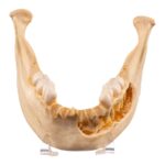Real Human Mandible – Dissected