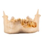 Real Human Mandible – Dissected