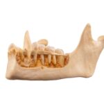 Real Human Mandible – Dissected