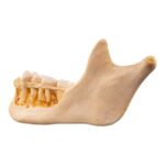 Real Human Mandible – Dissected