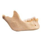 Real Human Mandible – Dissected