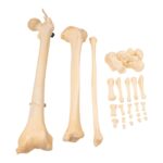 Real Human Left Leg – Pathology