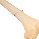 Real Human Left Leg – Pathology