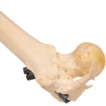 Real Human Left Leg – Pathology