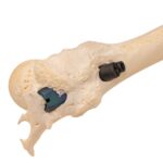 Real Human Left Leg – Pathology