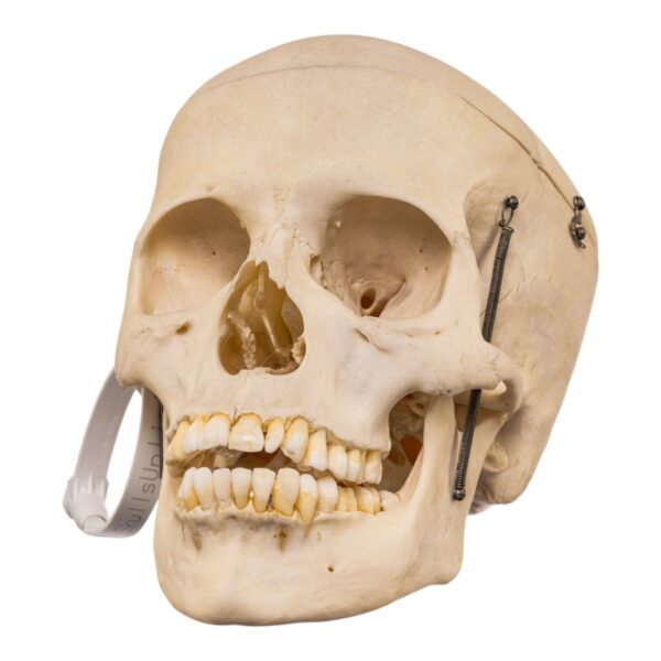 Real Human Skull – 512 g