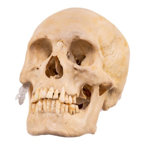 Real Human Skull - 688 g
