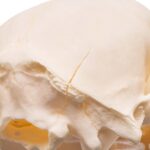 Real Adolescent Raccoon Skull – Pathology