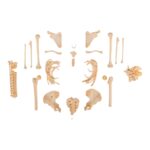 Real Human Skeleton – Partial – Pathology