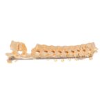Real Human Skeleton – Partial – Pathology