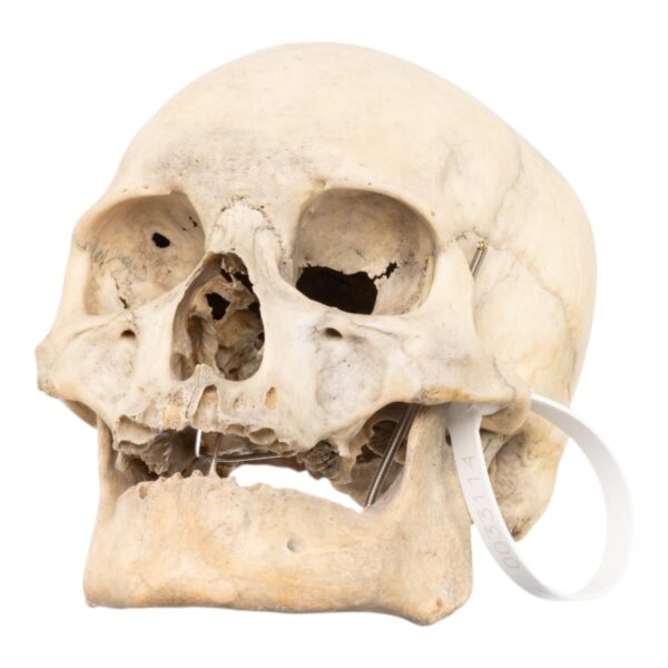 Real Human Skull – 792 g