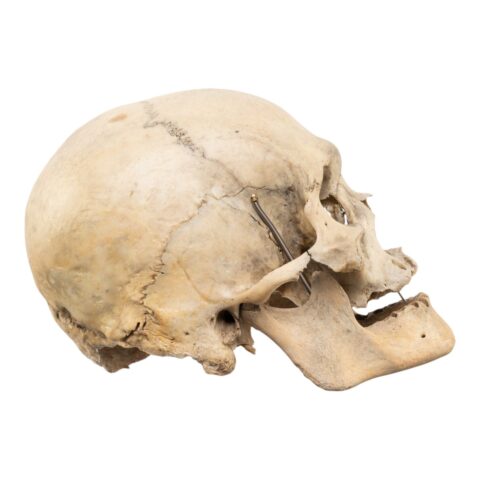 Real Human Skull - 792 g