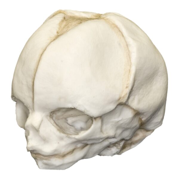 Replica Human Fetal Skull – 20 Weeks