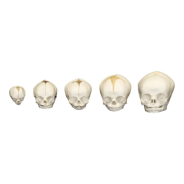 Replica Human Fetal Skulls – Set of 5