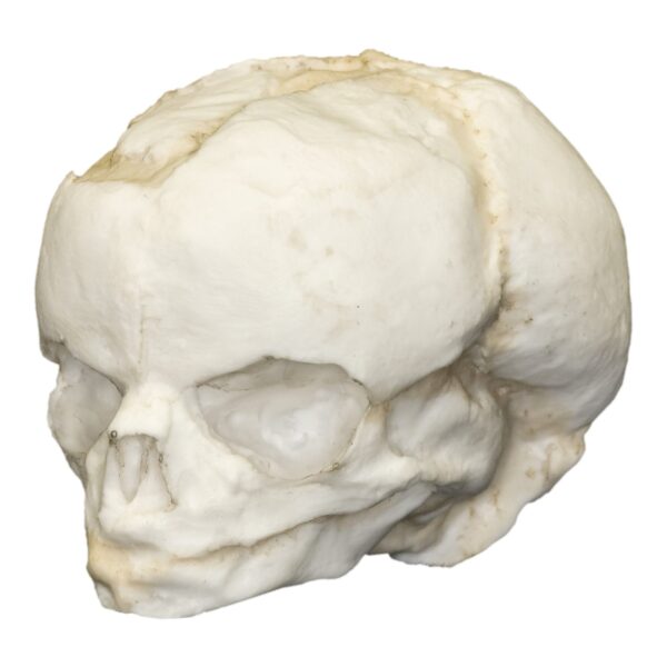 Replica Human Fetal Skull – 17 Weeks