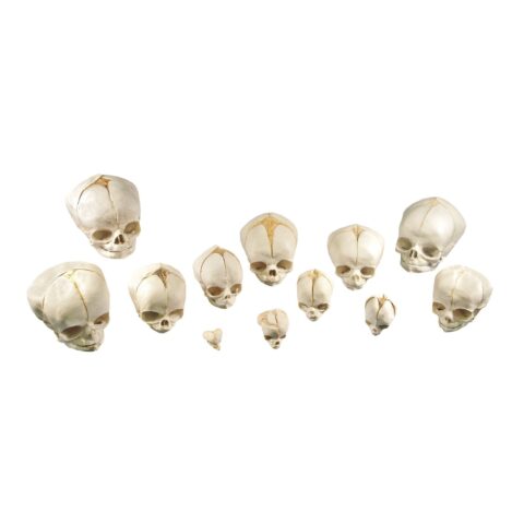 Replica Human Fetal Skull Development Kit - Set of 12