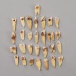 Real Human Tooth with Decay – Single