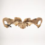 Real Human Pelvis and Sacrum – Antique