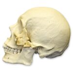Replica Human Skull – Healed Trauma