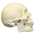 Replica Human Skull – Healed Trauma