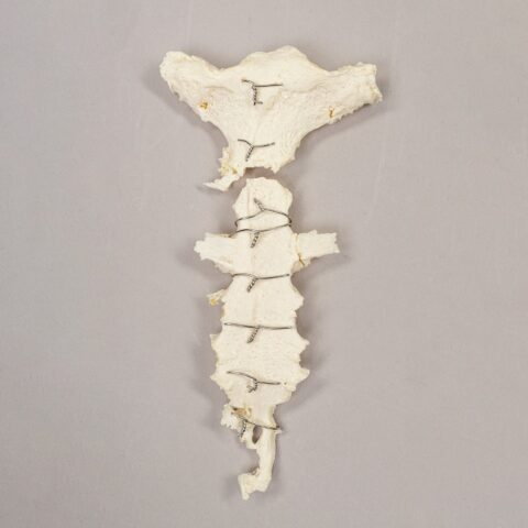 Real Research Quality Human Sternum and Ribs