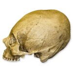 Replica Human Skull – Trephined