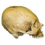Replica Human Skull – Trephined