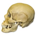 Replica Human Female with Multiple Gunshot Wounds Skull