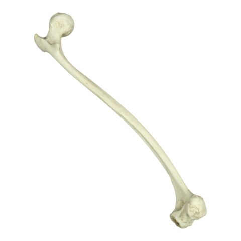 Replica Human Left Femur with Polio